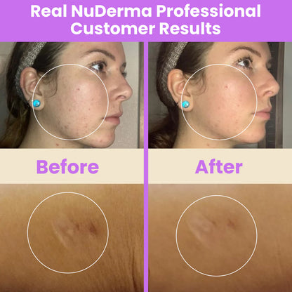 Professional-Grade Results Without the Professional Price Tag